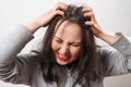 Closeup woman hand itchy scalp, Hair care concept Royalty Free Stock Photo