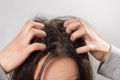 Closeup woman hand itchy scalp, Hair care concept Royalty Free Stock Photo