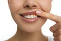 Young woman showing inflamed gums, closeup view