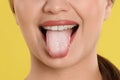 Young woman showing tongue with white patches on yellow background, closeup. Oral candidiasis thrush disease