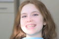 Young woman with silicone invisible transparent braceson teeth in dentistry.