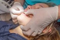 young woman or teenage girl having braces fitted at dentist