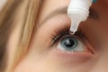 Young woman using eye drops, closeup view Royalty Free Stock Photo