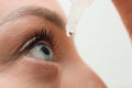 Young woman using eye drops, closeup Royalty Free Stock Photo