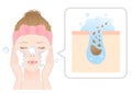 Young woman washing face for blackheads with skin layer. before and after. Skin care concept