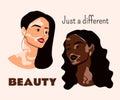 Young women live with vitiligo. Different beauty, self love, body positive