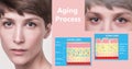 Younger skin and aging skin. elastin and collagen. Royalty Free Stock Photo