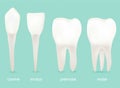 4 Types of Teeth. In your mouth.