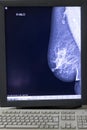 Zagreb, Croatia - June 14, 2017: mammogram results on display fr