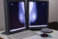 Zagreb, Croatia - June 14, 2017: mammogram results on display fr