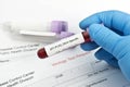 Zika Virus Lab Test Royalty Free Stock Photo