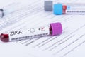 Zika Virus Lab Test form Royalty Free Stock Photo