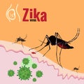 Zika Virus Outbreak and Mosquito sucking blood on skin Royalty Free Stock Photo