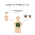 Zika virus. Symptoms of infection. Infographics. Vector illustration