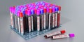 ZIKA virus - test tubes, blood tests - 3D illustration Royalty Free Stock Photo