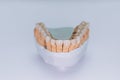 Zirconium crowns veneers. Ceramic teeth with the veneers on a plaster model isolated on white background. Ceramic bridge Royalty Free Stock Photo
