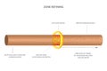 Zone refining is a technique to get highly pure crystals of impure elements mostly used for silicon and germanium