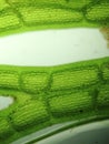 Zoom microorganism algae