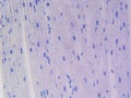 Zooming in on Cardiac Tissue: Detailed View of Nuclei, Striations, and Discs