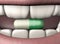 3d illustration antidepressant pill in human mouth with strong teeth