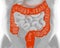 3D illustration of the human large intestine.