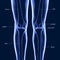 3D Illustration of Human Skeleton Tibia and Fibula Bones