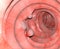 3d illustration of the intestinal polyps