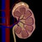 3d illustration of the kidney stones