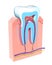 3d illustration of the section of a tooth showing the anatomical interior.