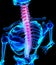 3D Illustration of spine painful.