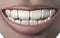 3d illustration of woman mouth full of strong white teeth