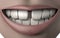 3d illustration of woman mouth full of strong white teeth with gap malocclusion smile