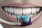 3d illustration of woman mouth full of strong white teeth toothbrush and toothpaste