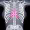 3D image female chest xray