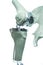 3D knee prosthesis for medicine