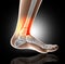 3D medical image showing broken leg bone