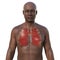 A 3D photorealistic illustration portraying an African man with transparent skin, showcasing his lungs affected by