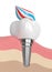 3d render of dental implant with toothpaste