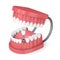 3d render of jaw with teeth and dental premolar implant