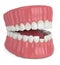 3d render of opened jaw with broken incisor lower tooth