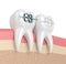 3d render of teeth with ceramic and metal braces