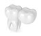 3d render of teeth with dental cantilever bridge