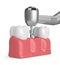 3d render of teeth with dental drill