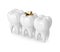 3d render of teeth with dental golden inlay filling