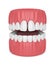 3d render of teeth with diastema