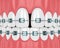 3d render of teeth with diastema and braces