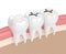 3d render of teeth with different types of dental filling