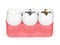 3d render of teeth with different types of dental filling