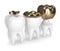 3d render of teeth with different types of dental gold filling