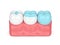 3d render of teeth with different types of filling